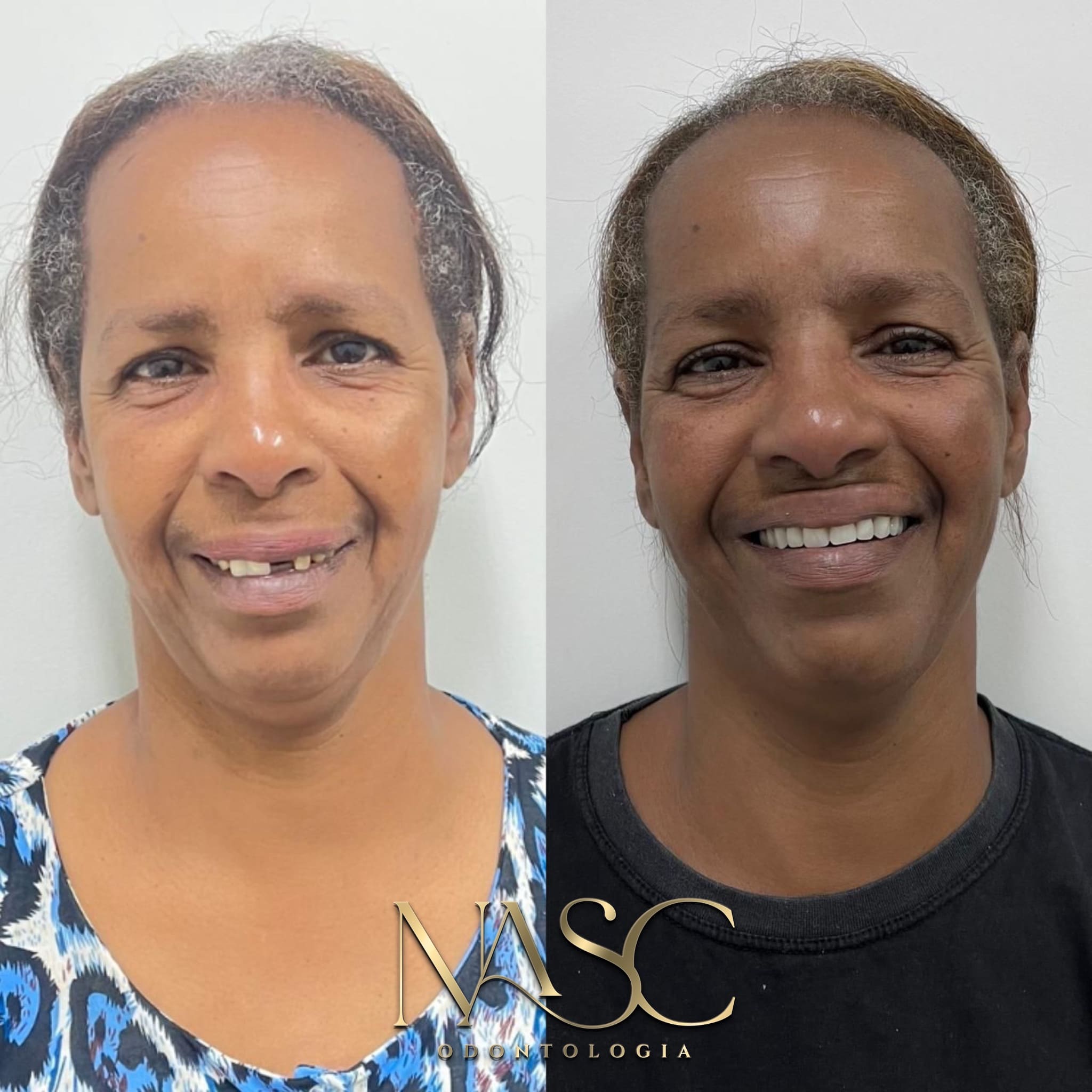 Prancheta 1 copiar 3